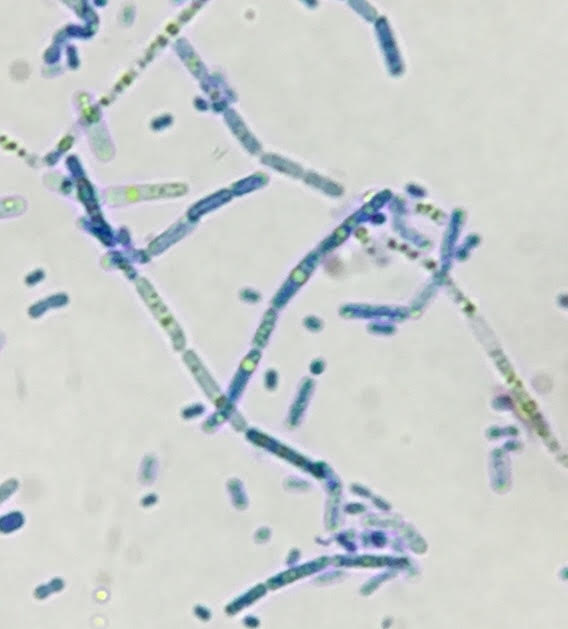 Bacterial isolation from a kitchen dish towel reveals the presence